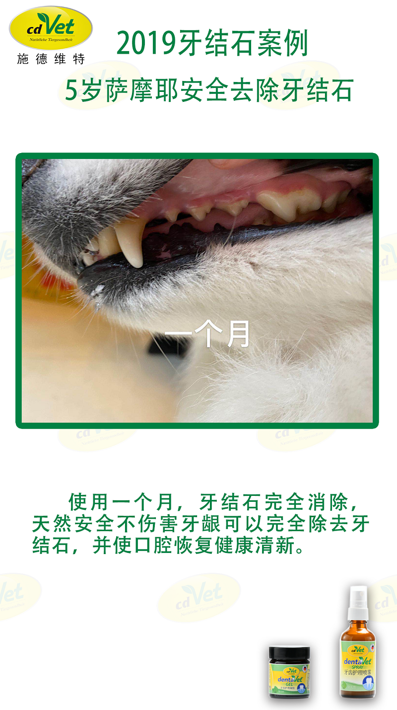 去除牙結(jié)石 5.png