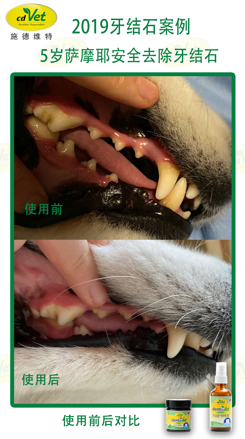 去除牙結(jié)石 6.png